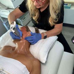 Esthetician Services Before & After Patient #599