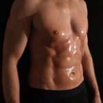 Liposuction Before & After Patient #4750