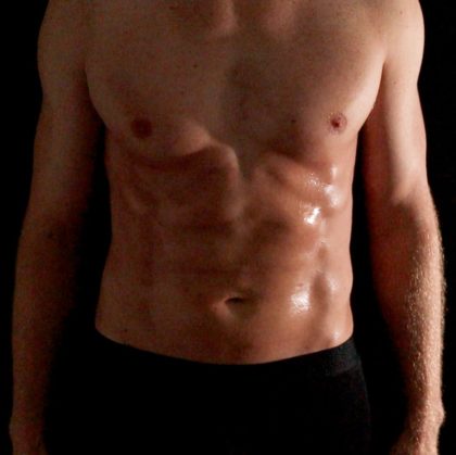 Liposuction Before & After Patient #4750
