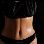 Tummy Tuck Before & After Patient #5144