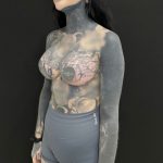 Breast Augmentation Before & After Patient #5233