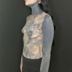 Breast Augmentation Before & After Patient #5233